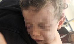 Vahşeti yaşayan 2 yaşındaki bebek hastanelik oldu