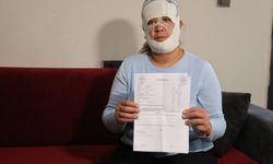 Güzelleşmek uğruna gittiği merkezde yüzü yandı