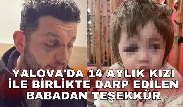 Yalova'da 14 aylık kızı ile birlikte darp edilen babadan teşekkür