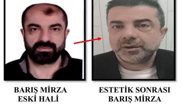 Ameliyat ile yüzünü değiştiren firari cinayet zanlısı, 7 yıl sonra yakalandı