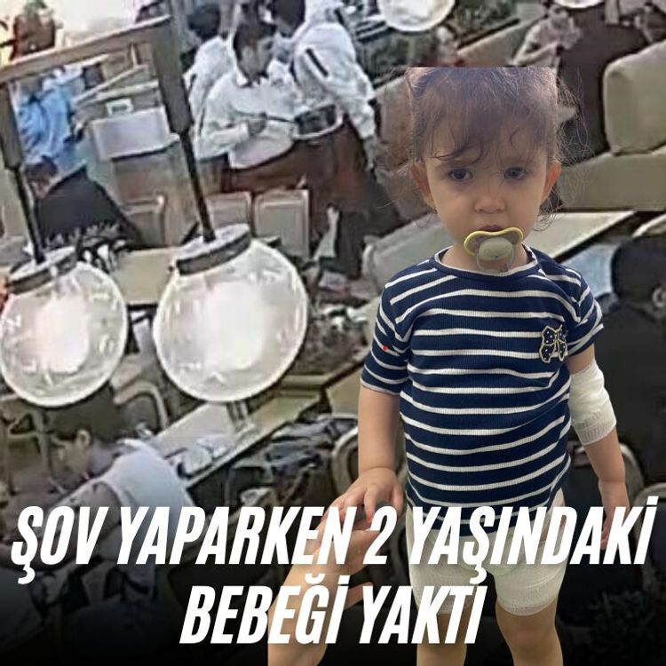 Şov yaparken 2 yaşındaki bebeği yaktı