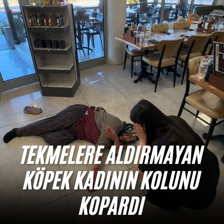 Tekmelere aldırmayan köpek kadının kolunu kopardı