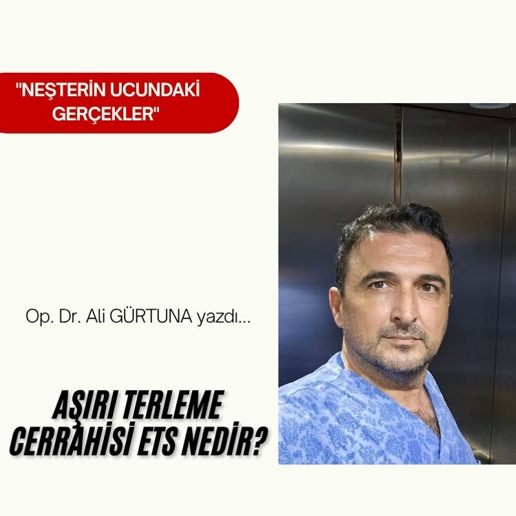 Aşırı Terleme Cerrahisi ETS Nedir?