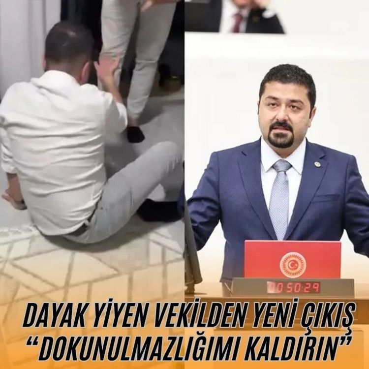Dayak yiyen vekilden yeni çıkış “Dokunulmazlığımı kaldırın”