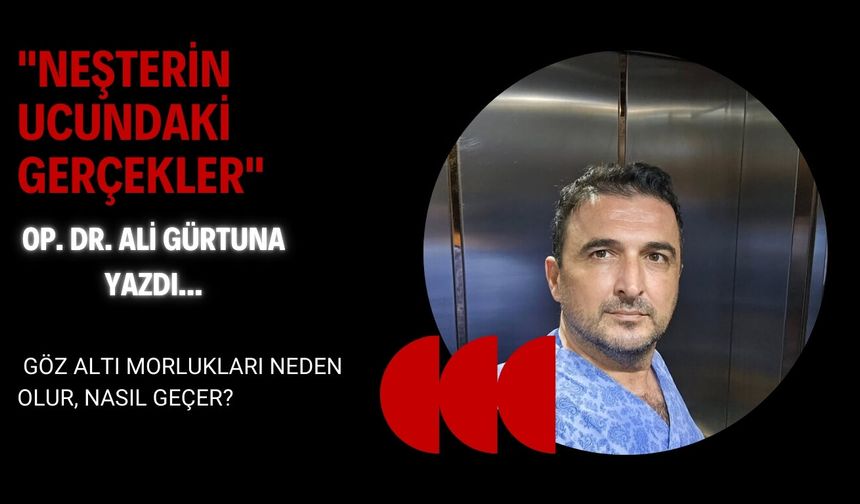 Göz Altı Morlukları Neden Olur, Nasıl Geçer?